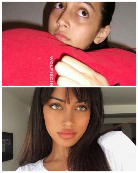 cindy nose|Wolfiecindy aka Cindy Kimberly, what do you think she did to